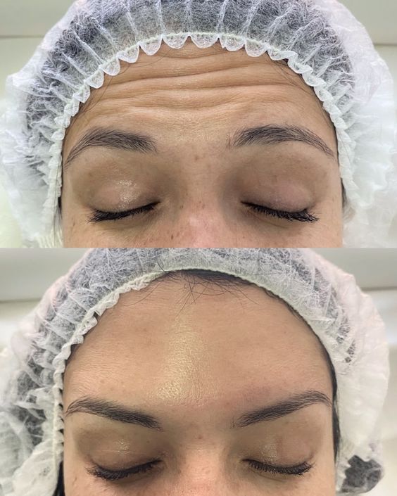 Результаты процедур — до и после