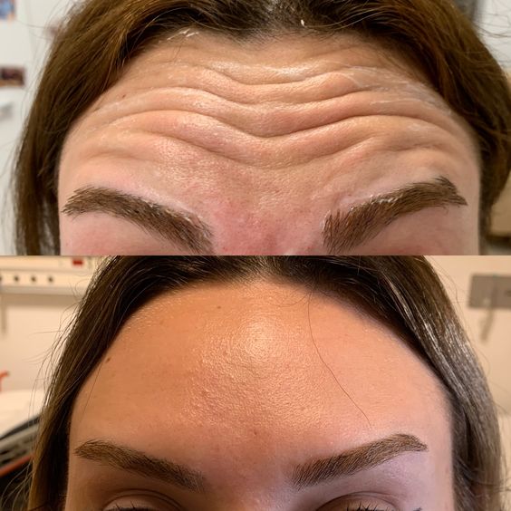 Результаты процедур — до и после